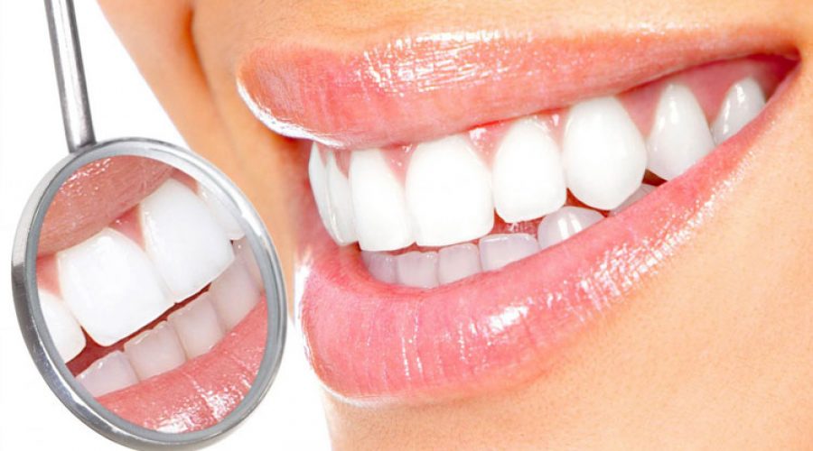 10 способов отбеливания зубов