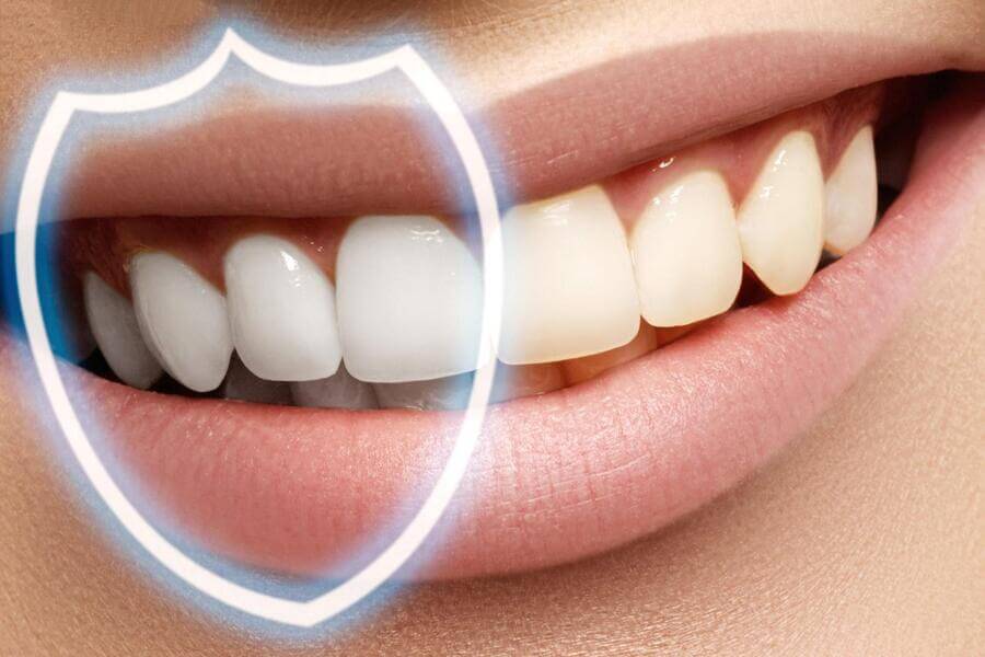 Диета после отбеливания зубов