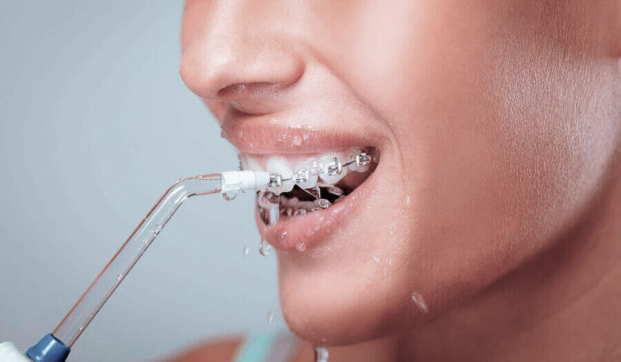 какой щеткой чистить зубы с брекетами