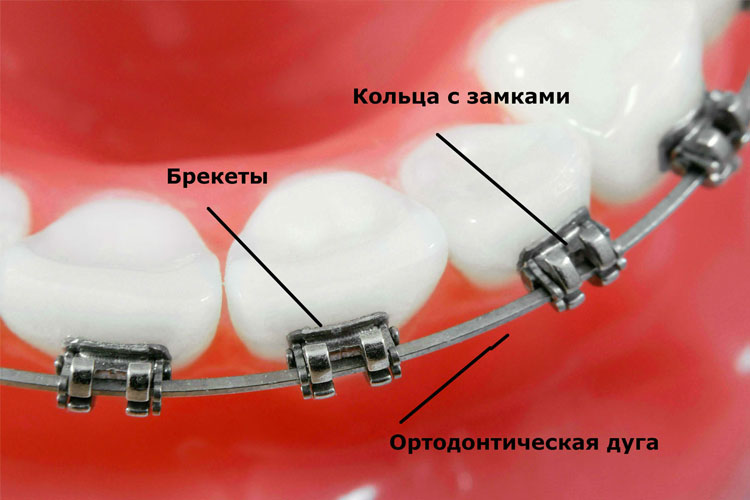 Имплантация зубов: какие у нас преимущества?