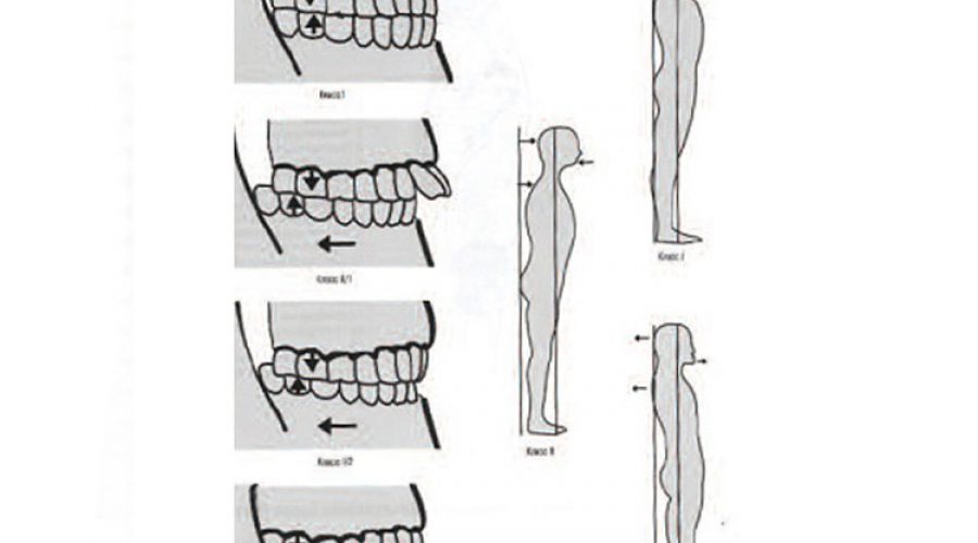 Нейром’язова стоматологія